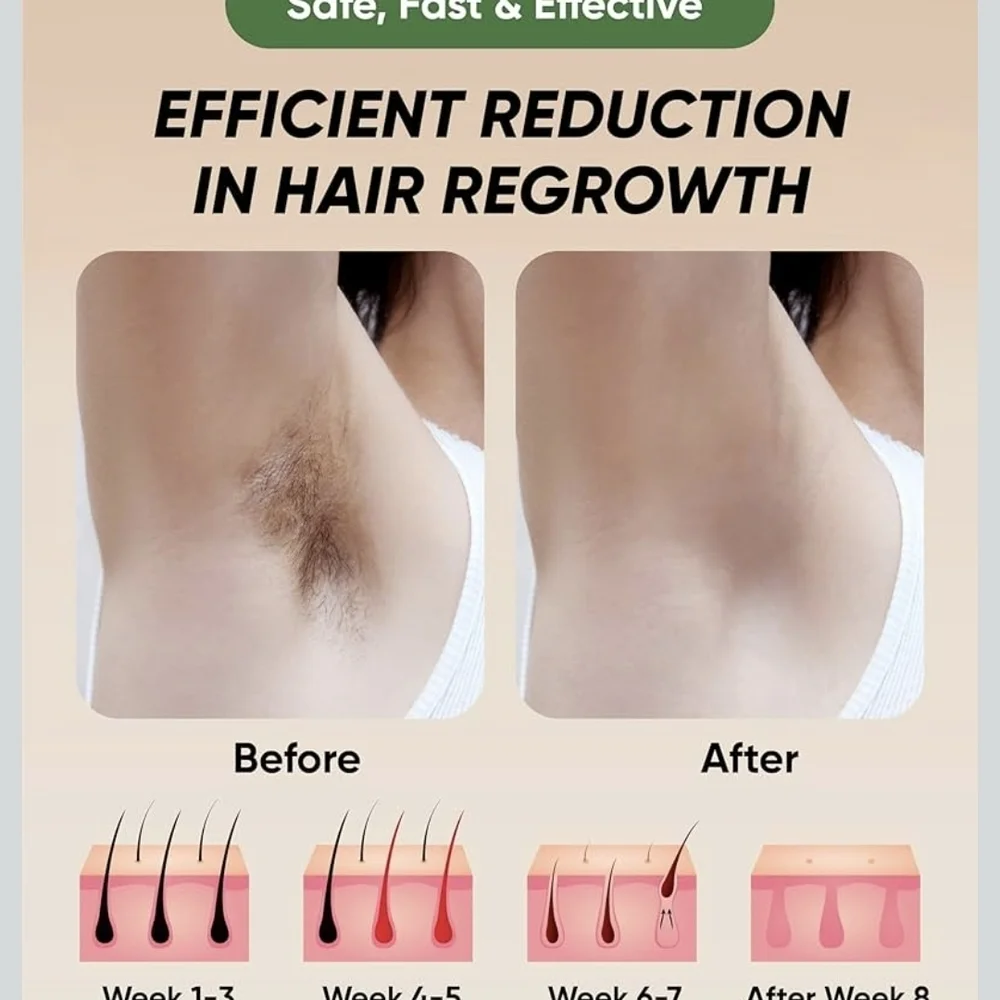 IPL Hair Removal Device - White